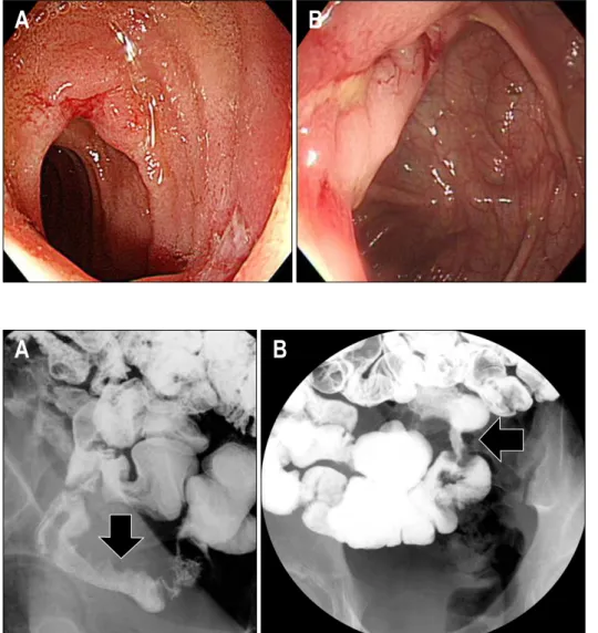 Fig.  3.  Small  bowel  series  findings. 