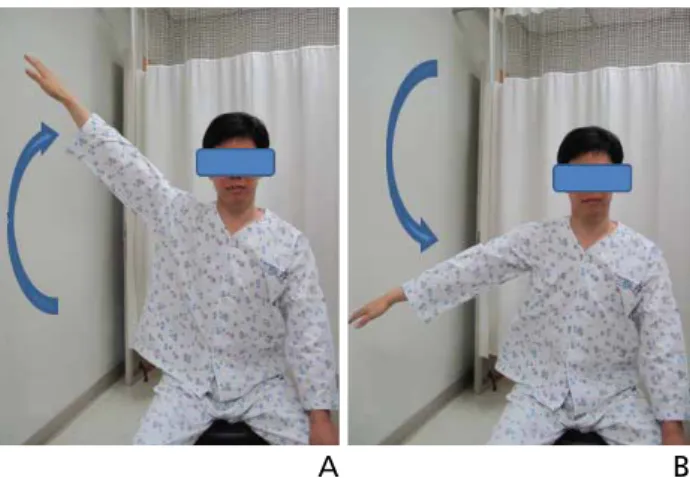 Figure 4.  Empty can test (Jobe’s test). The examiner assessed the deltoid with  the arm at 90° of abduction and neutral rotation