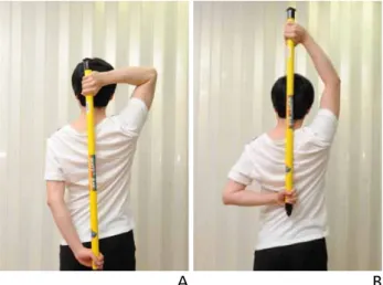 Figure 2.  The shoulder capsule is expanded (arrow heads) after intraarticular  hydraulic distention.