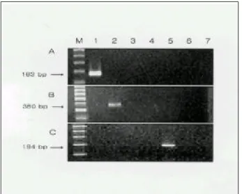 Fig. 2. PCR amplification products of Helicobacter spp. with H.
