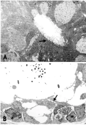 Fig. 3. Electromicroscopic findings. (A) Cecum in a normal control rat. There are no cellular necrosis, intact intercellular space and tight junction (arrow) are noted (×2,000)