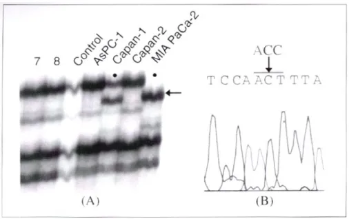 Fig. 2. SSCP analysis and DNA sequencing of exon 7. (A) Pancreatic cancer cell line Capan-1 and MIA PaCa-2 have aberrant bands on SSCP analysis (arrow)