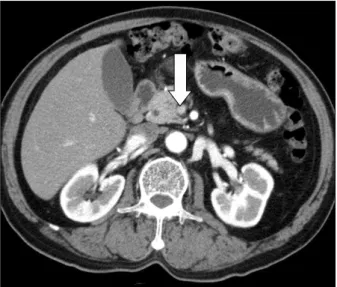 Fig. 3. Follow-up contrast-enhanced abdominal CT finding. 