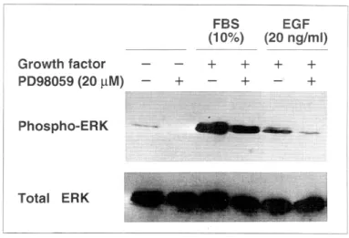 Fig. 5. Effects of PD98059 on ERK activity in Panc-1 cell line.