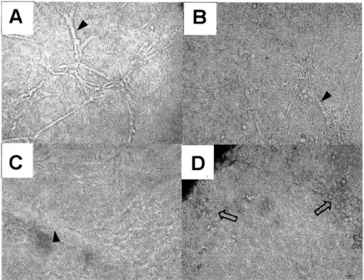 Fig. 4. In vitro effect of thalidomide on the proliferation of mouse hepatoma cells analyzed by MTT assay