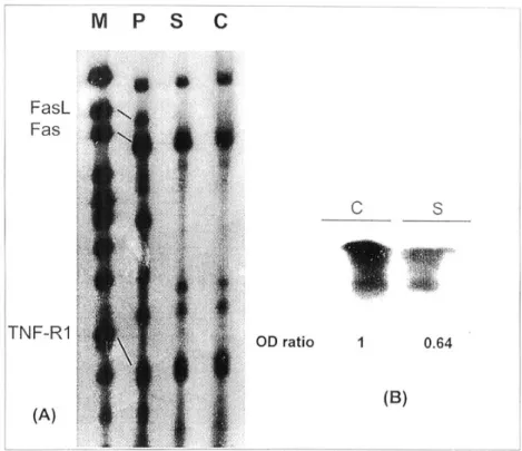 Fig. 9. RNA blot analysis of Fas, Fas ligand (FasL) and tumor necrosis factor receptor 1 (TNF-R1)