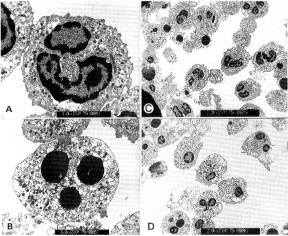Fig. 2. Transmission electron microscopy of neutrophil apoptosis. (A), a freshly isolated normal neutrophil (magnification ×11,200); (B), an apoptotic neutrophil with electron dense chromatins in the fragmented nuclei (magnification ×12,600); (C), neutroph
