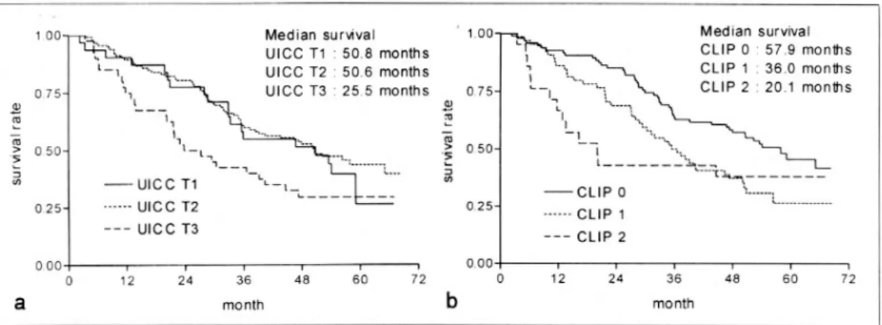 Fig. 3. Survival analysis of the patients with operable hepatocellular carcinoma according to the tumor stage