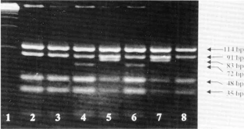 Fig. 1. Apo E genotyping by PCR and RFLP. Lane 1, marker (100 bp ladder); lane 2, apo E3/3;
