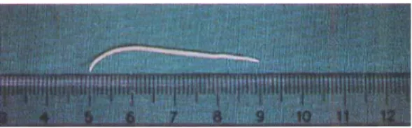 Fig. 1. Gross specimen of the larva from Case 1. Its body length and width is 43×2.27 mm.