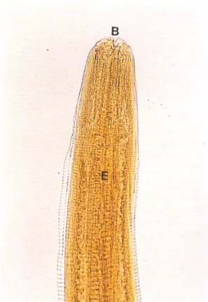 Fig. 3. Ventricular level of the larva from Case 1. E, esophagus; C, intestinal cecum; V, ventriculus (after  clear-ing with lactophenol sol., ×40).
