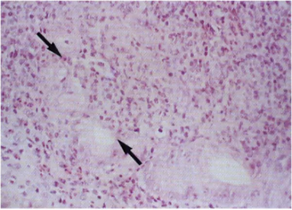 Fig. 3. Upper gastrointestinal endoscopic findings after eradication of H. pylori. They showed disappearance of multiple nodules and erosions on the antrum (A) and the second portion of the duodenum (B).