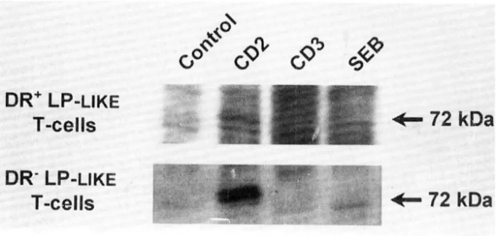 Fig. 4. Tyrosine phosphorylation profile of DR+ and DR- subsets of LP-like T-cells. DR+ and DR- subsets of LP-like T-cells were magnetically sorted and their phosphorylation profile were analyzed by immunoblotting