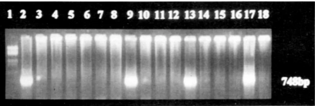 Fig. 1. Detection of serum HBV DNA in patients with alcoholic liver disease by PCR. PCR products were run on 1.5% agarose gel with ethidium bromide