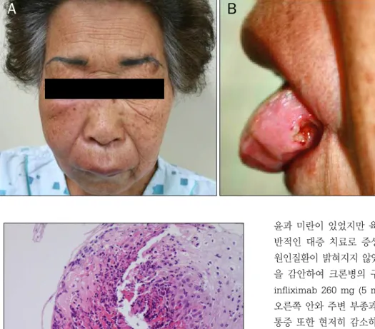 Fig. 1. Initial orofacial manifestations.
