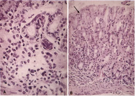 Fig. 4. H&amp;E stained gastric tissue from a C57BL/6 mouse infected for 8 weeks with H