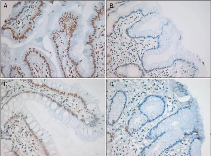 Fig. 1. Immunohistochemistry for  γH2AX and phospho-53BP1 proteins were detected in the nuclei of epithelial and interstitial inflammatory  cells of the gastric mucosa (×200)