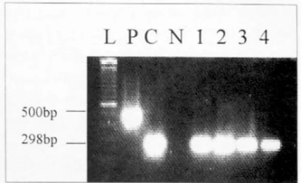 Fig. 2. PCR using cagA primer pairs. PCR was perfor- perfor-med on four different genomic DNA samples of bacterial isolates