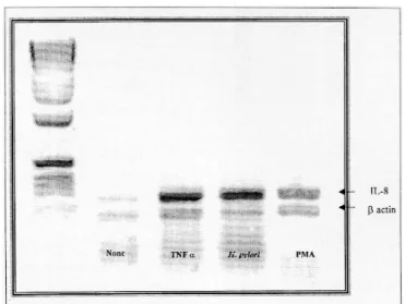 Fig. 1. IL-8 mRNA expression by AGS cell line induced by various stimuli. Cellular RNA was extracted by guanidinium  thiocyanate-phenol-chloroform method