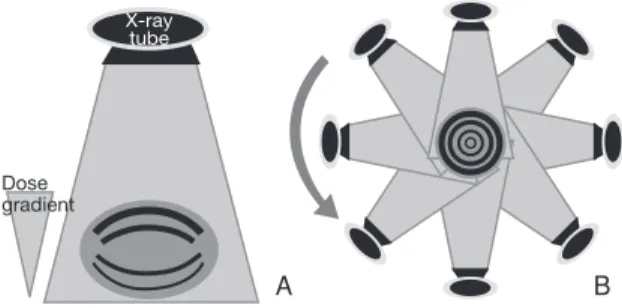 Figure 1.   Radiation dose difference between general X-ray (A) and  computed tomography (CT) (B)