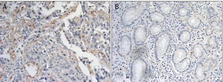 Fig. 3. Immunohistochemical staining with vascular-endothelial cadherin (VE-cadherin) (×200)