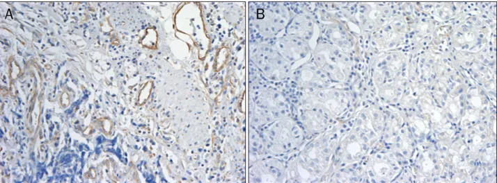 Fig. 9. Immunohistochemical staining with vascular endothelial growth factor (VEGF) (×200)