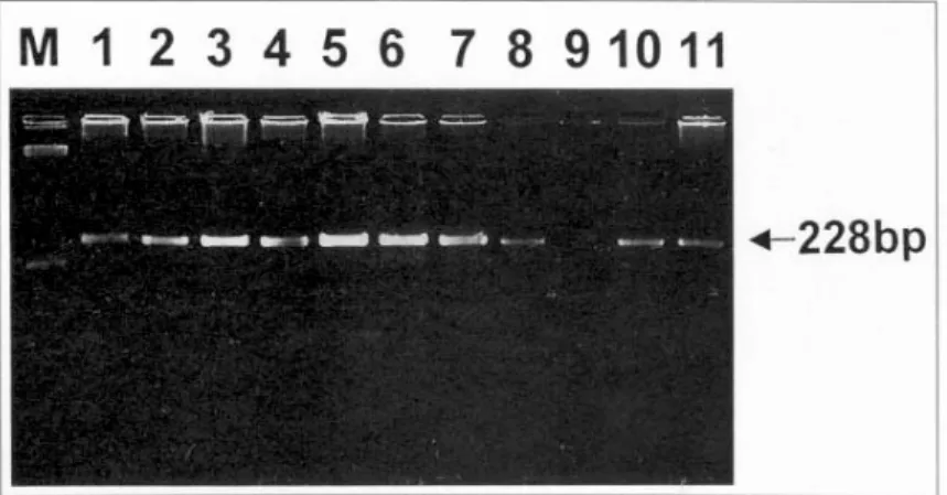 Fig. 1. Detection of amplified product of PCR for apo E typing, showing a single band with a length of 228 bp