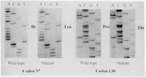 Fig. 1. Sequencing profile around codon 97 and 130. (Ile, isoleucine; Leu, leucine; Pro, proline;