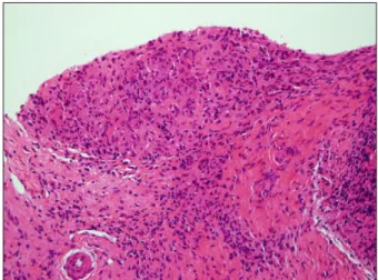 Fig. 5. Microscopic findings of the liver. The specimen showed chronic granulomatous inflammation with caseous necrosis (H&amp;E, ×100).