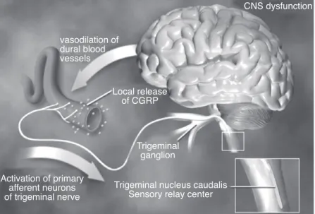 Figure 1. Pathophysiology of migraine (Neurovascular theory).