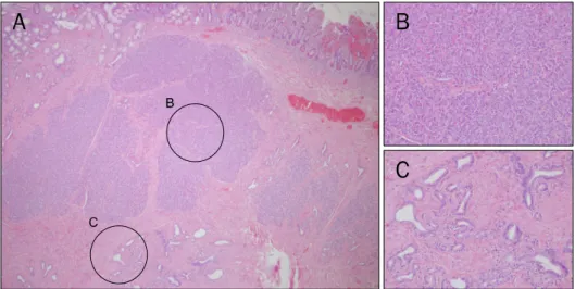 Fig. 4. A portion of the jejunum charac- charac-terized as longer and with more  irre-gular villi, no submucosal glands, and  no aggregated lymphatic nodules