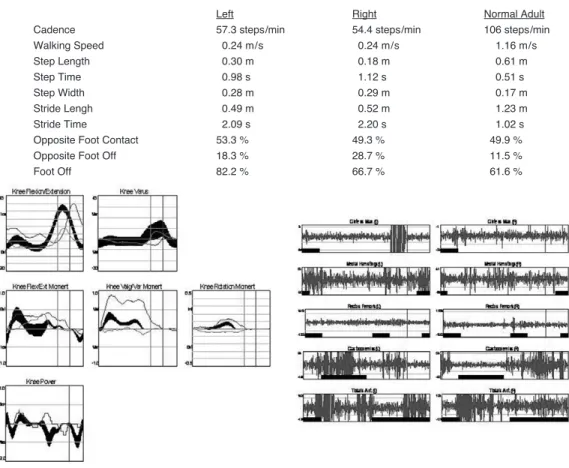 Figure 2. Findings of gait analysis include temporospatial, kinematic, kinetic, and electromyographic parameters