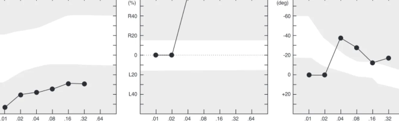 Figure 4. The results of sinusoidal harmonic acceleration test.  It shows gain (top right), symmetry (top left), phase (bottom) on right acute vestibulopathy patients