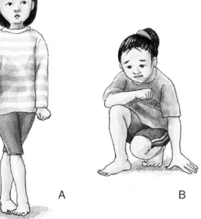 Figure 1. Holding techniques in girls. 
