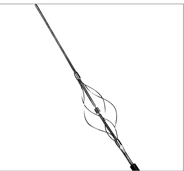 Figure 2.  Arrow -Trerotola thrombectomy device. Thrombus can be pulverized by rapid propelling motion of the basket and subsequently extracted through a side -hole of the  ca-theter