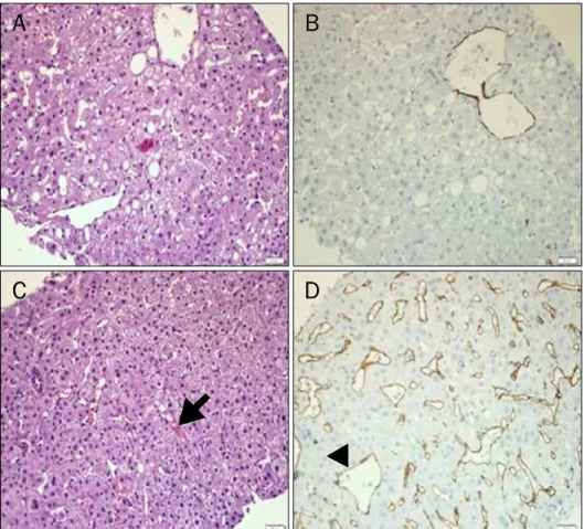 Fig. 4. Histopathology. (A) The non-  nodular portion shows a normal  parenchymal structure except for the  mild fatty change (H&amp;E stain, ×100).