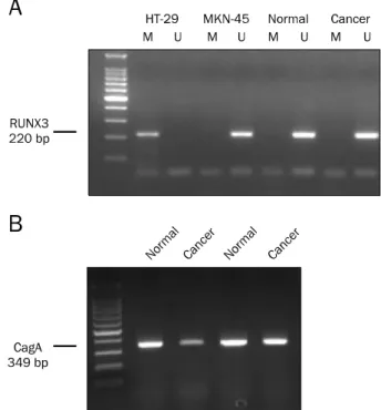 Fig. 1. Representative results of methylation-specific PCR for RUNX3 and PCR for CagA in human normal and gastric cancer tissue  samples