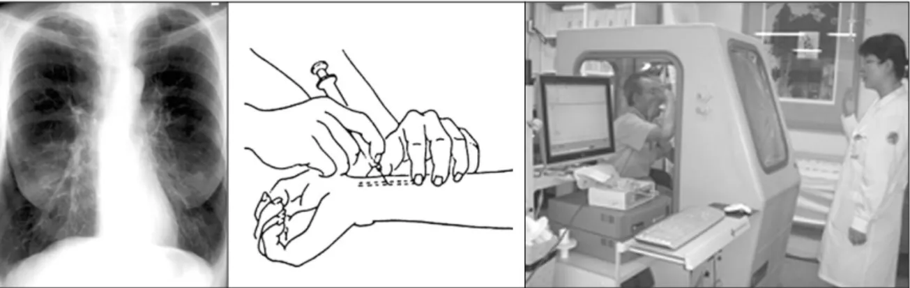 Figure 1. Simple chest X－ray, arterial blood gas analysis and pulmonary function test to diagnose the cause of dyspnea initially