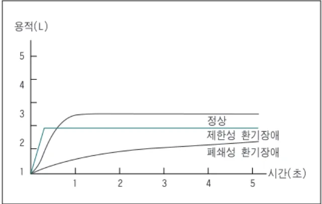 Figure 3. The volume－time curves of normal, obstructive and restrictive ventilatory impairment