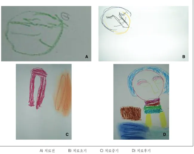 Figure 5. Rt. hemiplegia d/t SAH (M/54세) 임상사례：도형/색상 따라 그리기