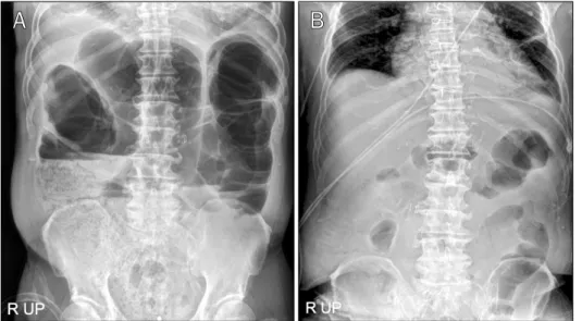 Fig. 1. Plain abdominal radiographs. 