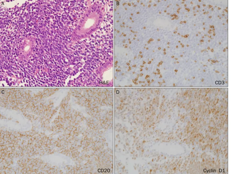 Fig. 3. Gastric mucosal biopsy and immunohistochemistry from fundus and high body. Magnification ×400
