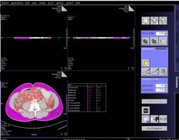Fig. 2. Intra-abdominal gas measurements by image processing work- work-station software