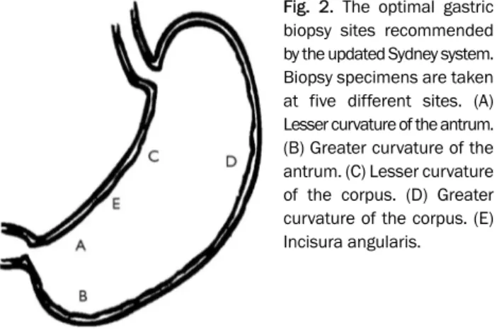 Fig. 2. The optimal gastric  biopsy sites recommended by the updated Sydney system.