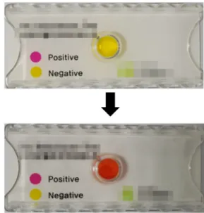 Fig. 1. Rapid urase test. When Helicobacter pylori produce ammonia  then pH will increase and the color of the medium will change from  yellow to red.각  지역에서  효과가  검증된  키트를  이용하여야  한다.1,21,22H