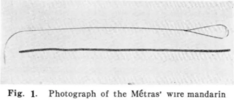 Fig.  2- D.  The  catheter  has  passed  glottis  and  entered  the  trachea. 