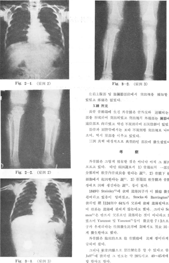 Fig.  2- 1.  (파例  2)  Fig.  2- 2.  (짧例  2)  Fig.  3- 1.  (값例  3)  Fig.  3- 2.  (하씨  3) Z디右J.: )ω{fll 벚 1않{싸líírj部{j'[에서 찢 /:I:ll’“-룹  때3 9:11 할 수 있었고 jgj써은 없었다