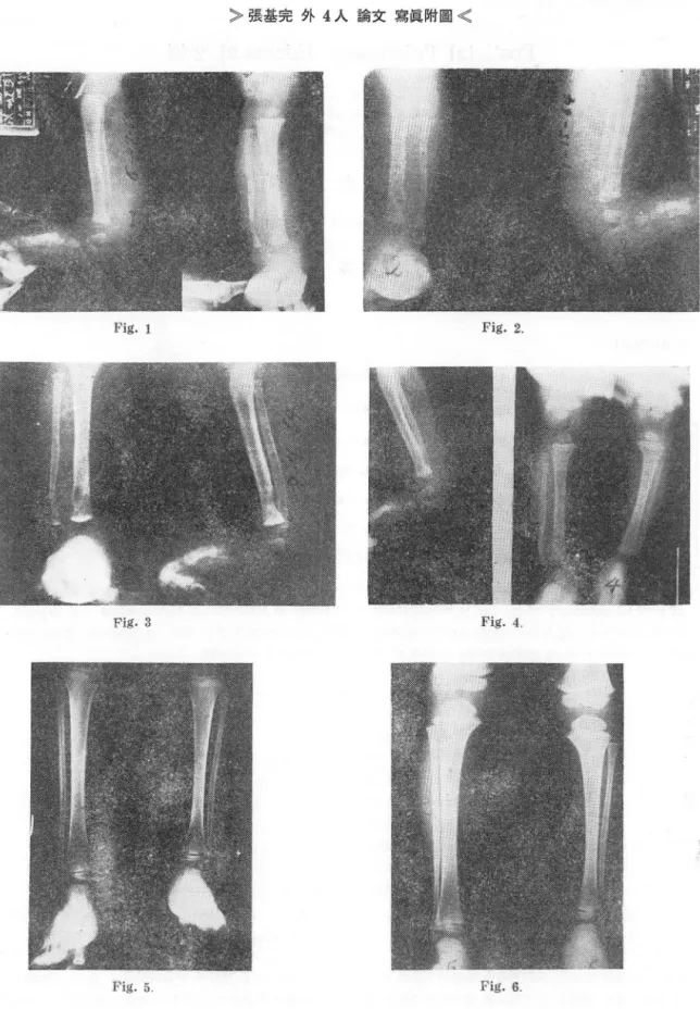 Fig.  1  Fig.2. 