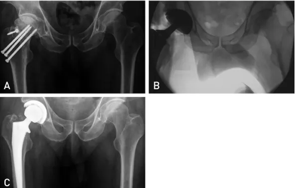 Table 4. Pre- and Postoperative Radiographic Results