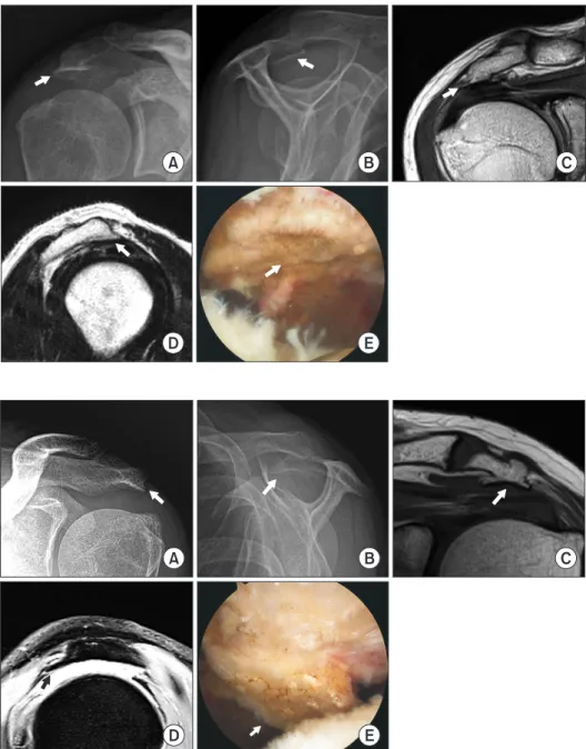 Fig. 1. Plain X-ray, magnetic resonance im- im-ages, and arthroscopic image of heel spur